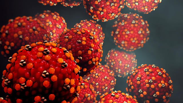 Measles virus or virus 